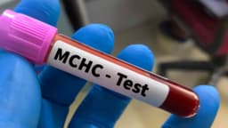 MCHC thấp trong xét nghiệm máu là bệnh gì?