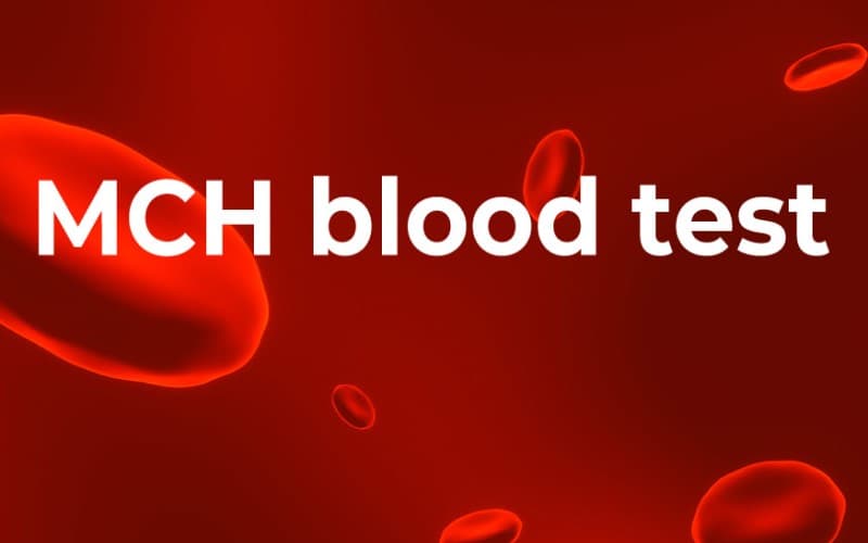 mchc trong máu cao là gì