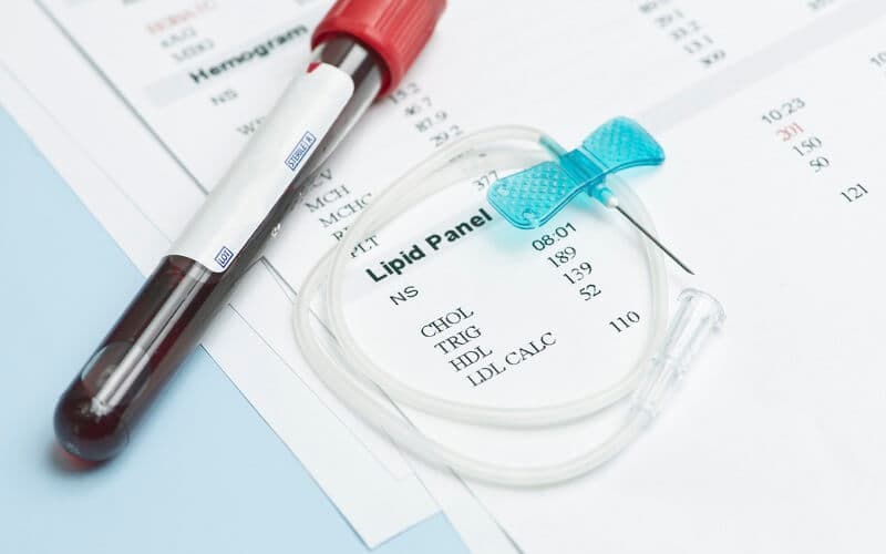 mchc trong máu cao là gì