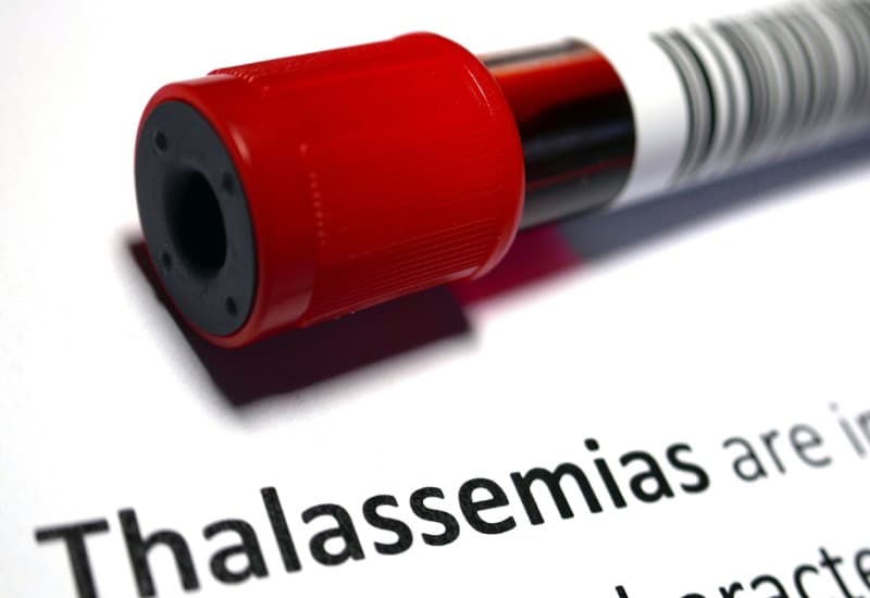 MCV thấp trong xét nghiệm máu là gì