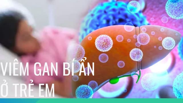 Men gan cao ở trẻ em có nguy hiểm không?