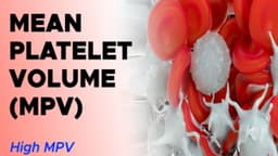 Chỉ số MPV cao trong xét nghiệm máu là bệnh gì?