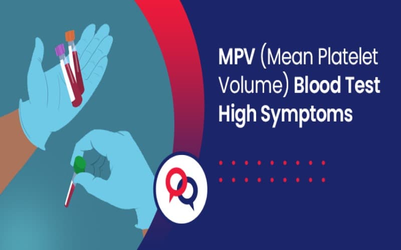 mpv cao trong xét nghiệm máu là gì