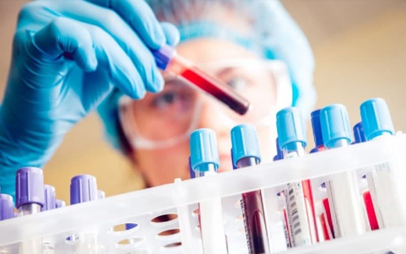 mpv cao trong xét nghiệm máu là gì