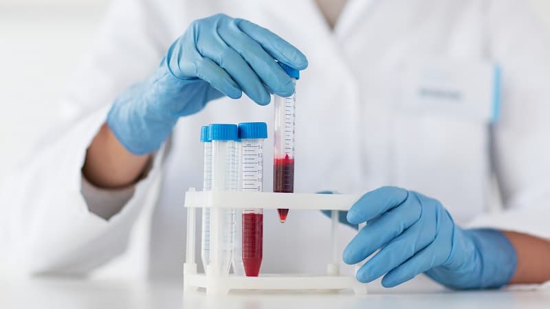 MPV thấp trong xét nghiệm máu là gì