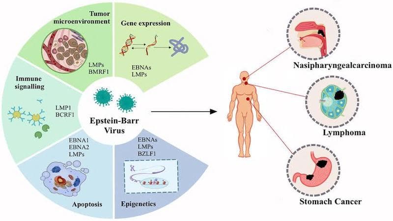 nguyên nhân ung thư vòm họng