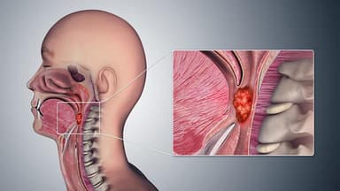 Biểu hiện sau khi đặt thuốc phụ khoa thành công, bao lâu thì ra bã?