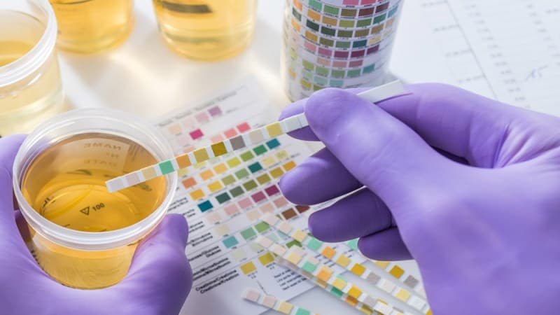 độ pH trong nước tiểu cao có sao không