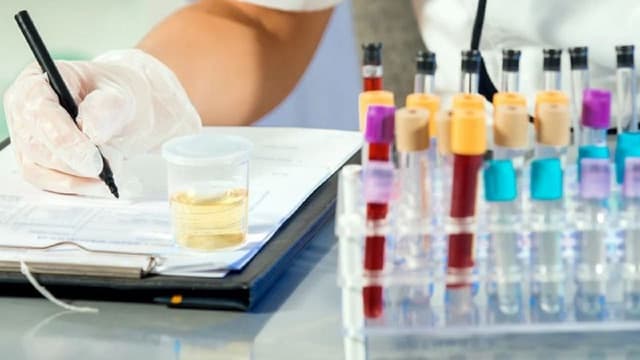 Kết quả xét nghiệm nước tiểu bình thường (và bất thường) tiết lộ điều gì?