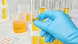 Lý do nước tiểu có mùi khai nồng nặc ở trẻ em