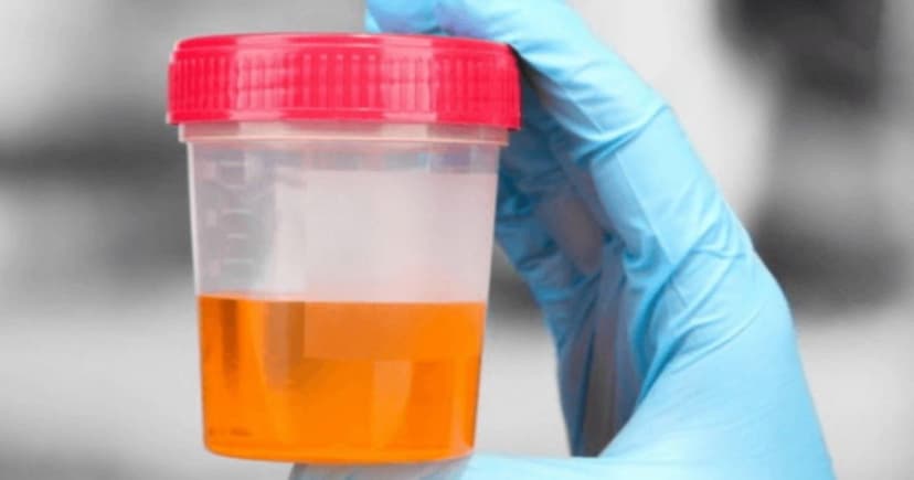 Vì sao nước tiểu có mùi tanh ở nữ và nam?