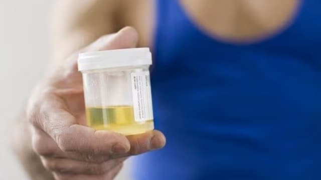 Nước tiểu có bao nhiêu màu? Màu gì là tốt nhất?