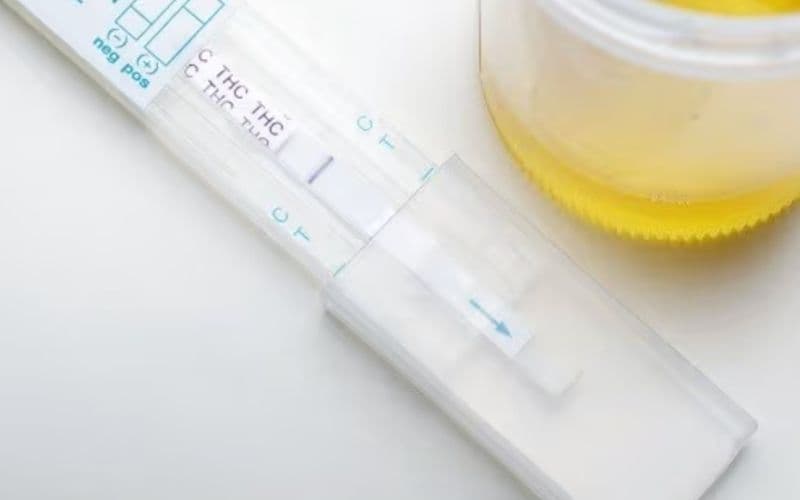 nước tiểu màu gì là tốt nhất