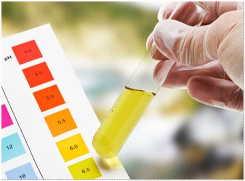 mùi khai của nước tiểu là chất gì