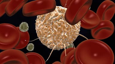 Rối loạn sinh tủy có phải ung thư không?