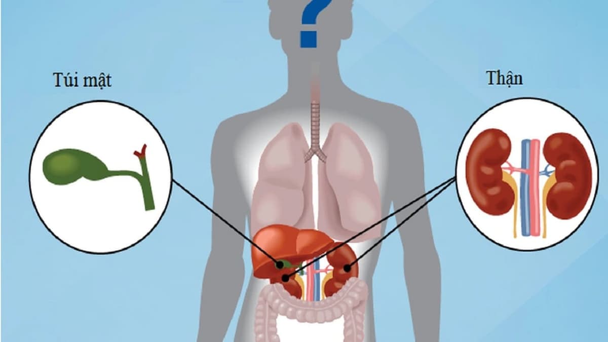 Sỏi thận và sỏi mật cái nào nguy hiểm hơn?