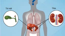 Sỏi thận và sỏi mật cái nào nguy hiểm hơn?
