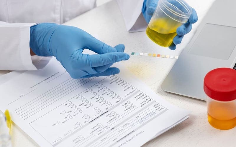 trace là gì trong xét nghiệm nước tiểu