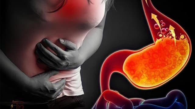 Trào ngược dạ dày gây ung thư vòm họng không?