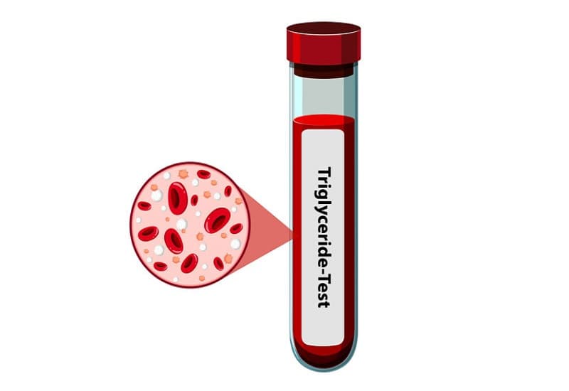 chỉ số triglyceride cao uống thuốc gì