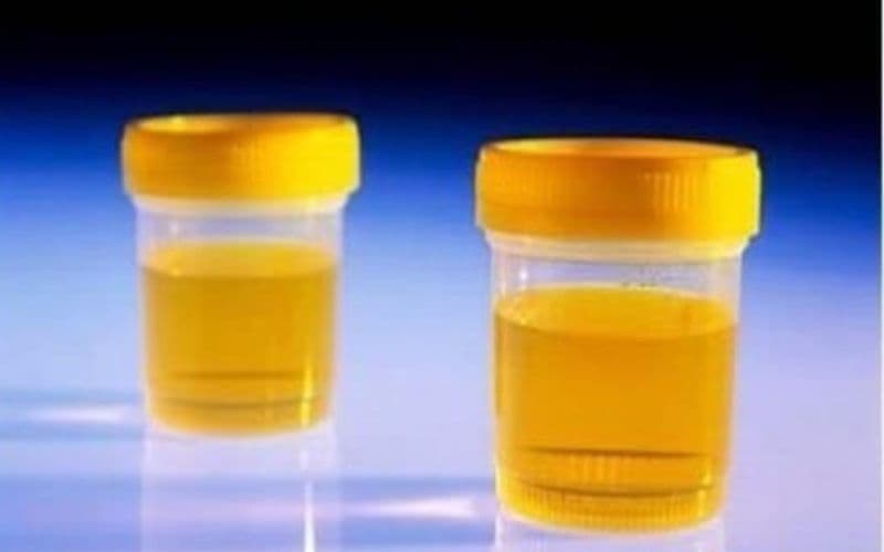 uống thuốc kháng sinh nước tiểu màu vàng