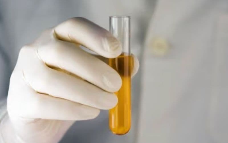 uống thuốc kháng sinh nước tiểu màu vàng