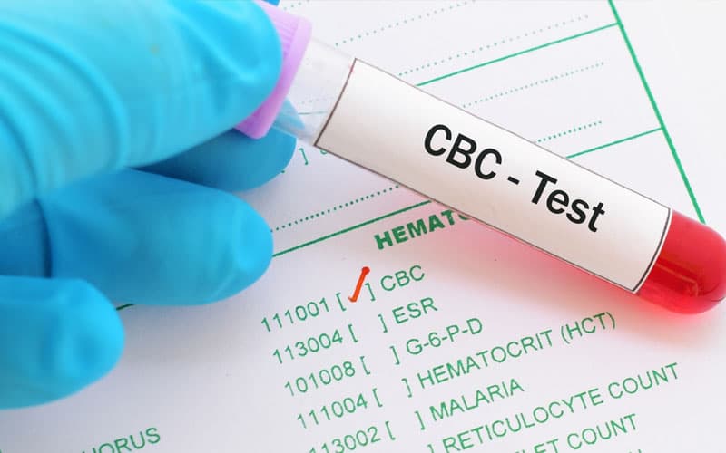 wbc trong xét nghiệm máu cao