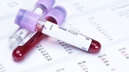 Chỉ số WBC trong xét nghiệm máu cao có nguy hiểm không?