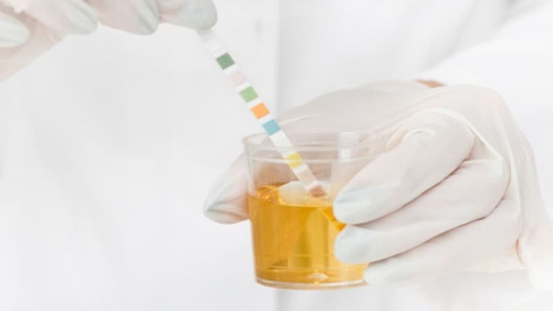 độ pH trong nước tiểu cao có sao không