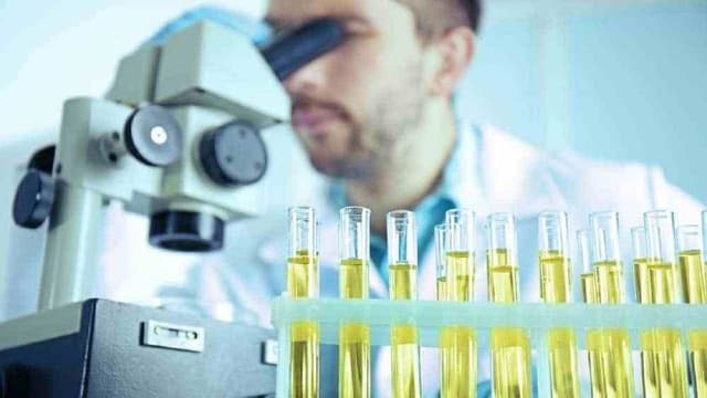 Xét nghiệm nước tiểu ra bệnh gì?
