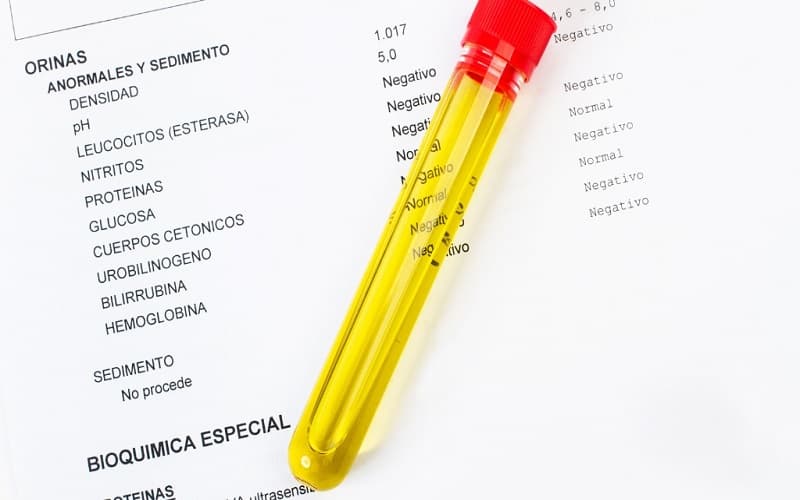 xét nghiệm nước tiểu ra bệnh gì