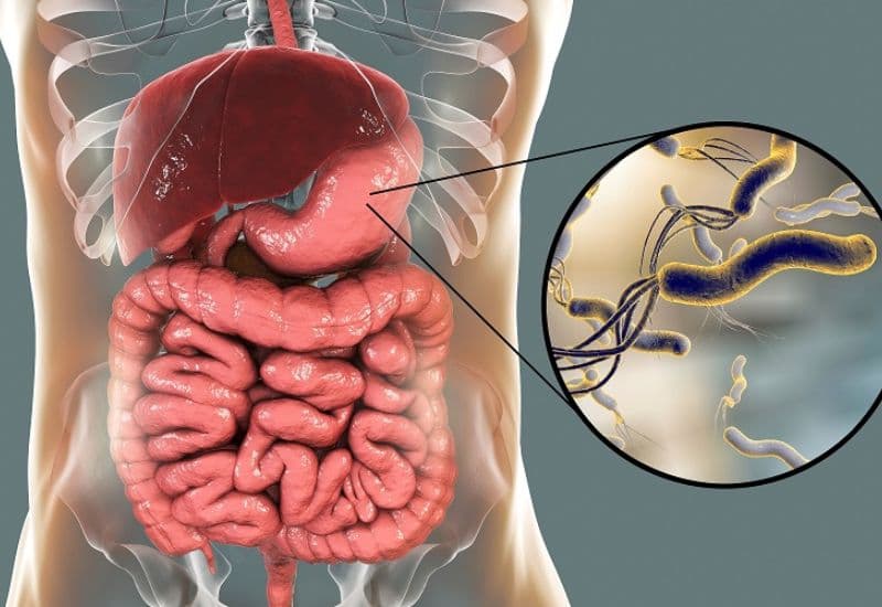 cắt polyp dạ dày có nguy hiểm không