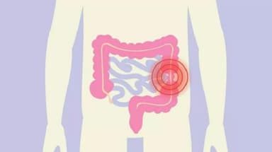 Hội chứng ruột kích thích và trào ngược dạ dày có khác nhau không?