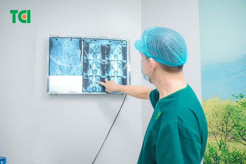 sỏi niệu quản 1/3 giữa