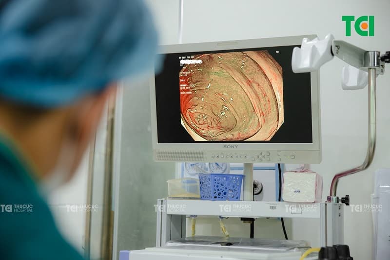 nội soi công nghệ nbi là gì