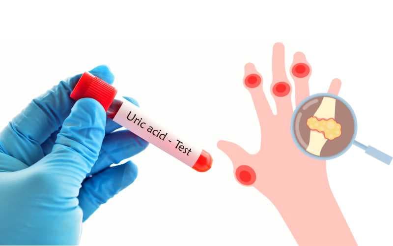 tại sao thuốc lợi tiểu làm tăng acid uric