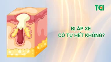 Bị áp xe có tự hết không?