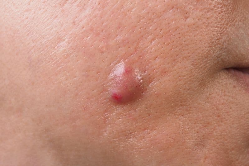 áp xe có tự hết không