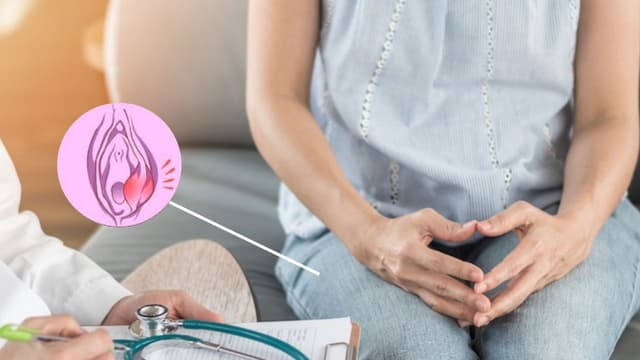 Áp xe tuyến bartholin là gì?