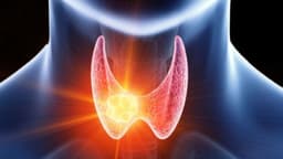 U tuyến giáp bao nhiêu là to, khi nào cần phẫu thuật?