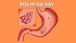 Cắt polyp dạ dày có mọc lại không?