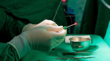 Đốt trĩ Laser có đau không? Giải đáp chi tiết về đốt trĩ Laser