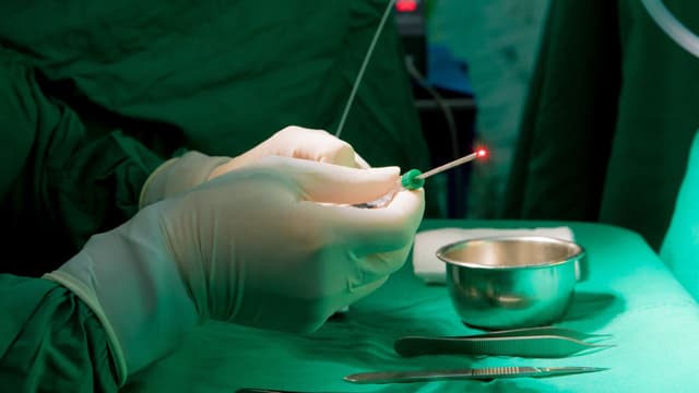 Đốt trĩ Laser có đau không? Giải đáp chi tiết về đốt trĩ Laser