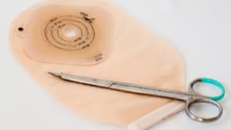 Bao lâu thay túi hậu môn nhân tạo 1 lần? Hướng dẫn thay