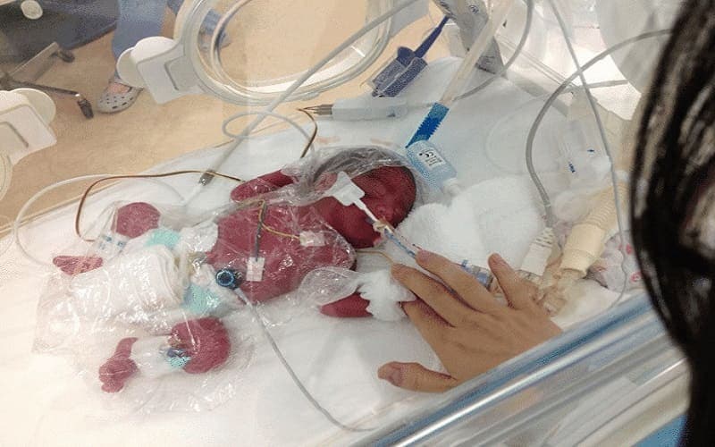 trẻ sinh non 1 tháng tăng bao nhiêu kg