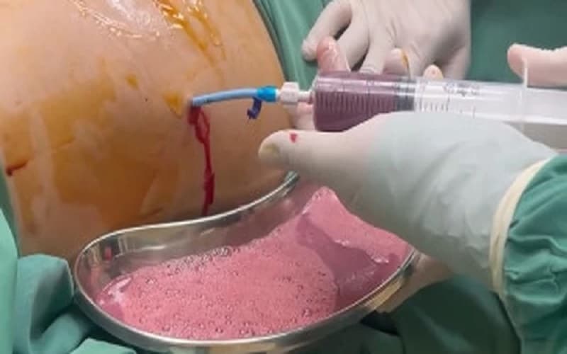 áp xe gan có nguy hiểm không