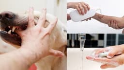 Bệnh dại lây qua đường nào? Có lây từ người sang người không?