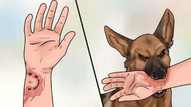 Vì sao bệnh dại ủ bệnh 10 năm hoặc hơn?