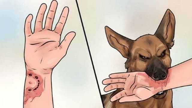 Vì sao bệnh dại ủ bệnh 10 năm hoặc hơn?