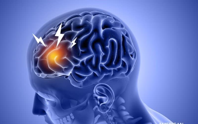 viêm màng não tự miễn là gì